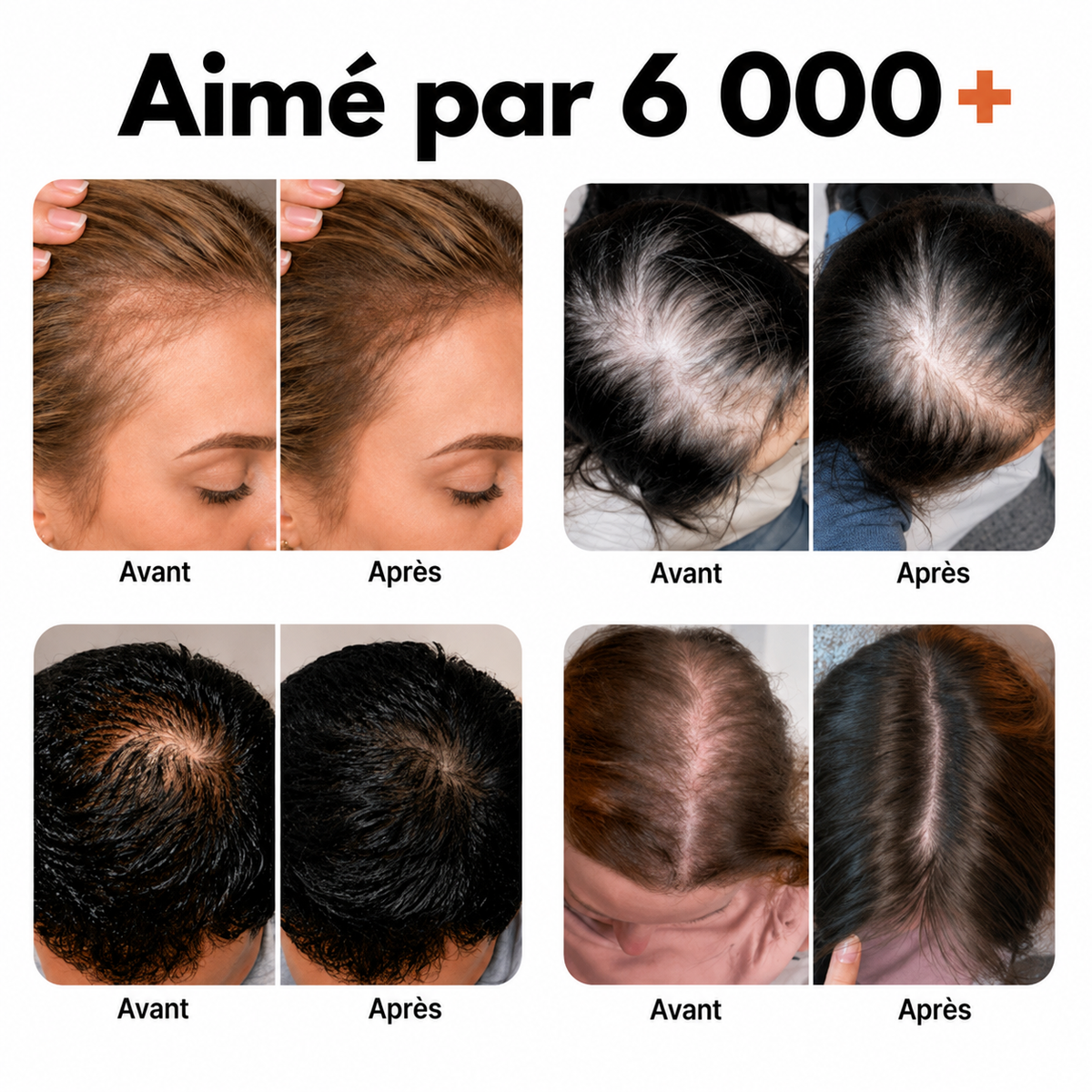 Shampooing Booster de Cuir Chevelu avec Brosse Intégrée