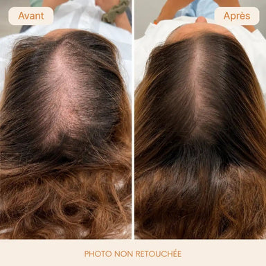 Sérum capillaire n°1 en Corée