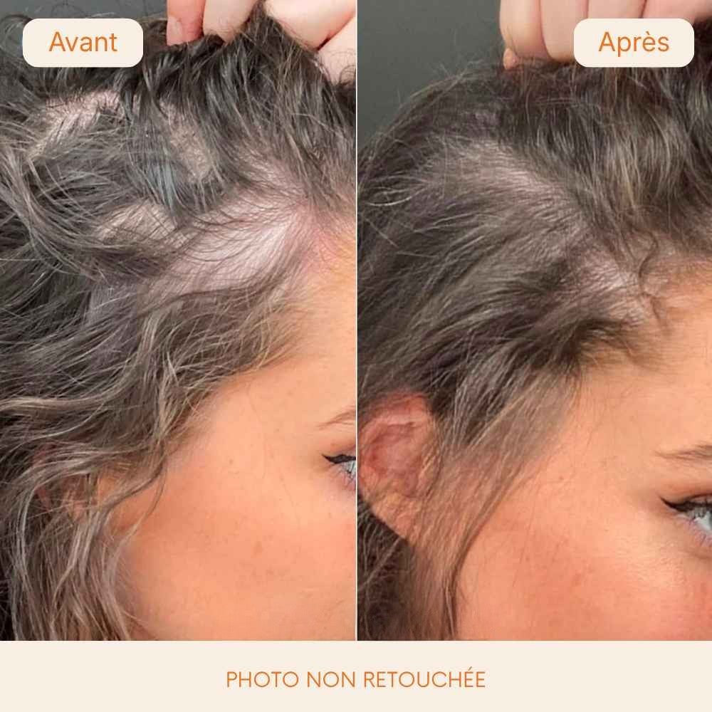 Sérum capillaire n°1 en Corée