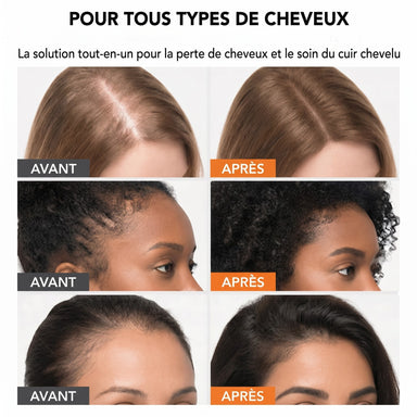 Sérum capillaire n°1 en Corée